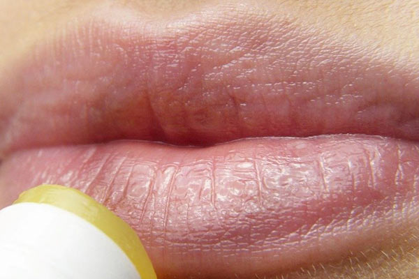 munherpes